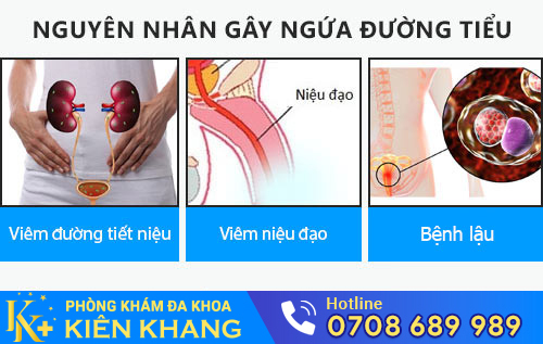 Ngứa đường tiểu là bệnh gì?