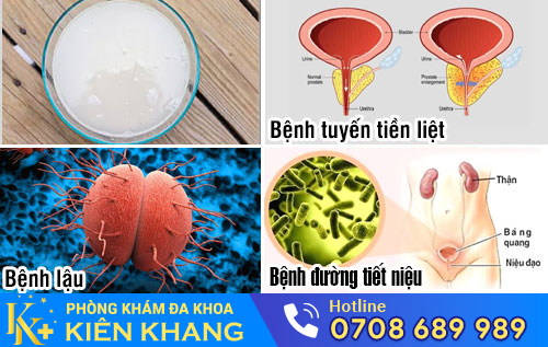 Nguyên nhân nước tiểu có màu lạ