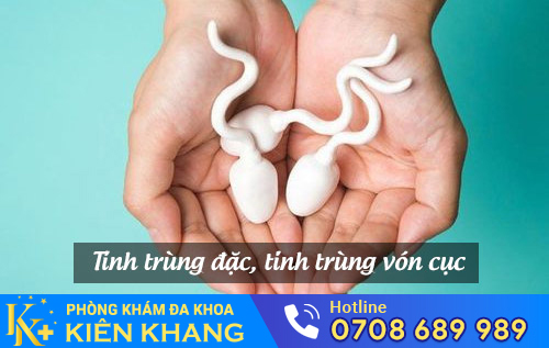 Tinh trùng đặc, tinh trùng vón cục