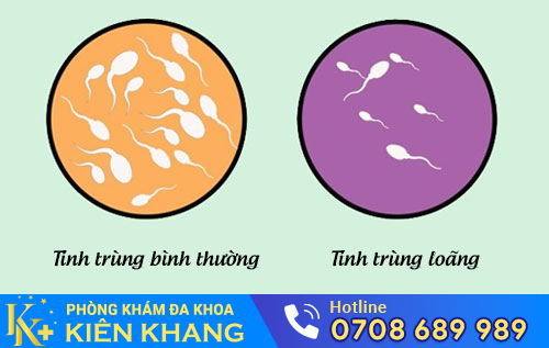 Tinh trùng loãng