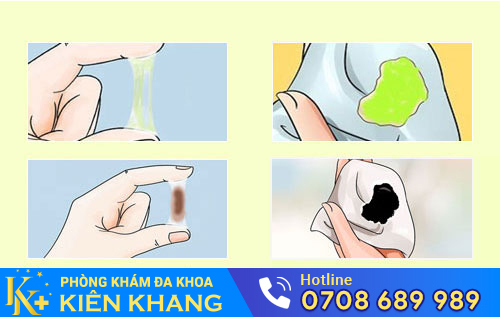 Huyết trắng có màu