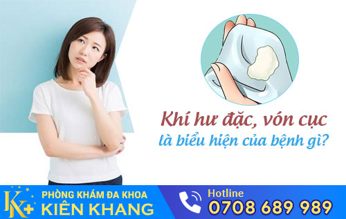 Khí hư đặc, vón cục