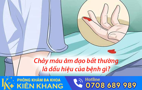 Chảy máu âm đạo bất thường