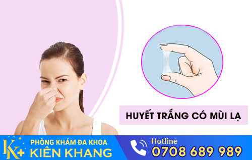 huyết trắng có mùi