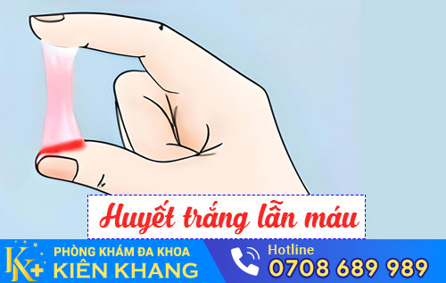 Huyết trắng lẫn máu