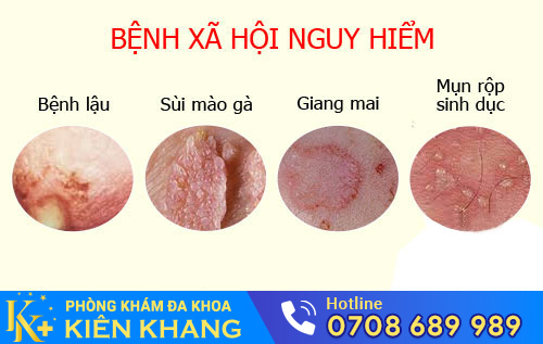 Nguyên nhân âm đạo có mùi
