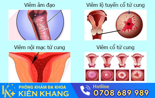 nguyên nhân đau hột le