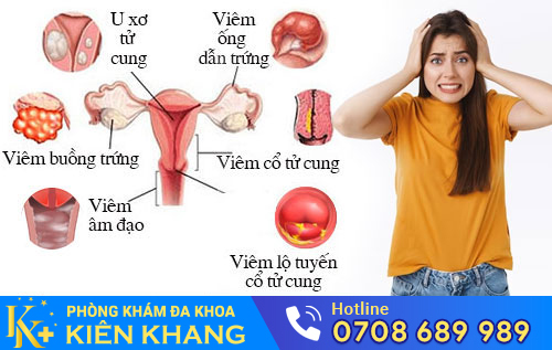 Nguyên nhân khí hư ra nhiều
