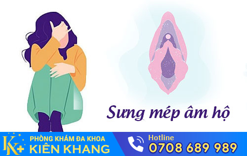 Sưng mép âm hộ
