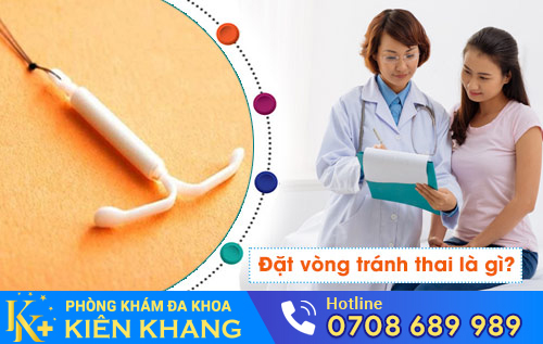 Đặt vòng tránh thai