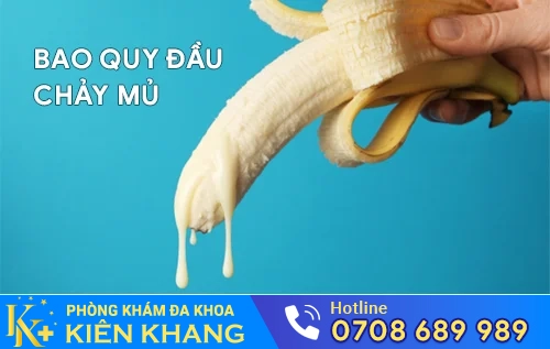 bao quy dau chay mu