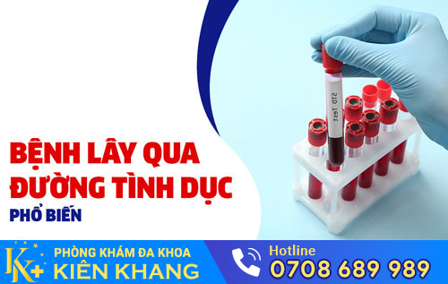 Các bệnh lây qua đường tình dục