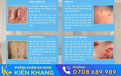 Triệu chứng, dấu hiệu bệnh xã hội