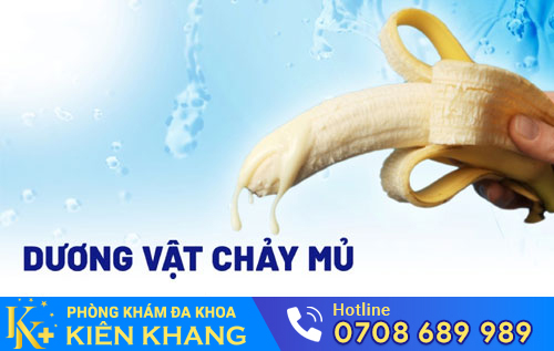 dương vật chảy mủ