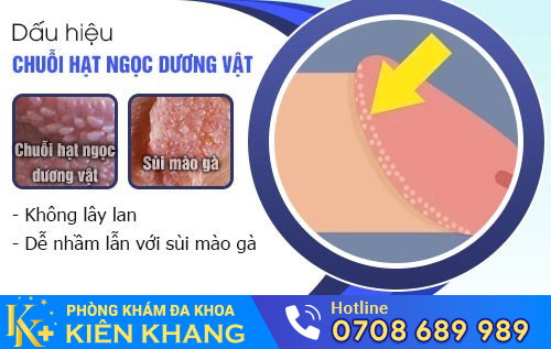 Hình ảnh hạt ngọc dương vật