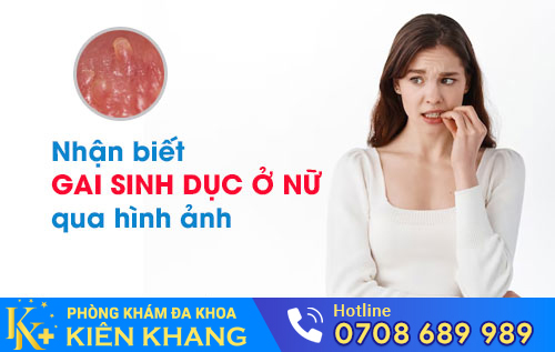 Nhận biết gai sinh dục nữ qua hình ảnh
