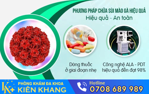 Thuốc điều trị sùi mà gà phải do bác sĩ kê toa