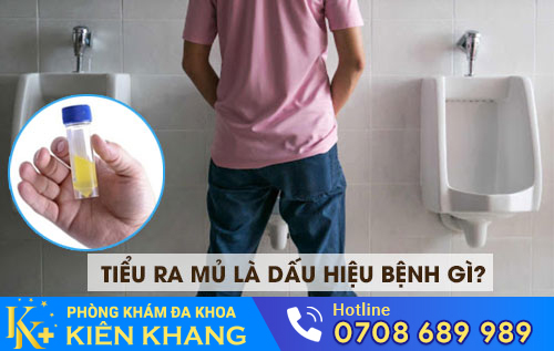 Tiểu ra mủ