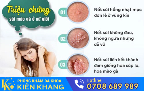 Sùi mào gà ở môi lớn, môi bé