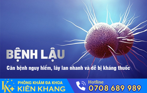Bệnh lậu