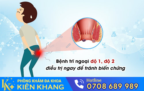 Bệnh trĩ ngoại độ 1 độ 2