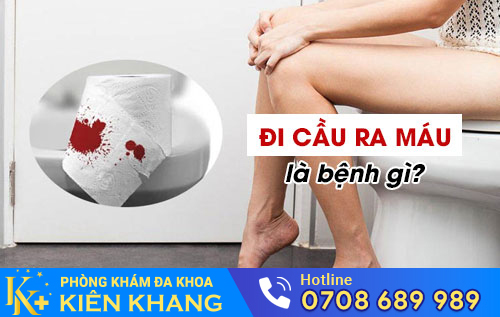 Đi cầu ra máu
