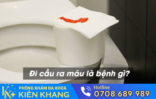 Đi cầu ra máu