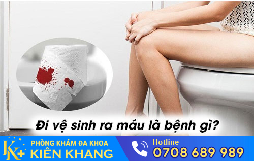 Đi vệ sinh ra máu