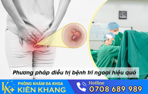 Phương pháp điều trị bệnh trĩ ngoại hiệu quả