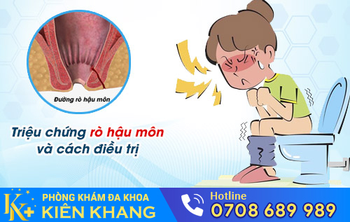 Rò hậu môn