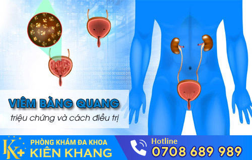 Viêm bàng quang